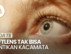 Ahli Kebugaran Spesialis Mata Sebut Softlens Tidak Bisa Gantikan Fungsi Kacamata